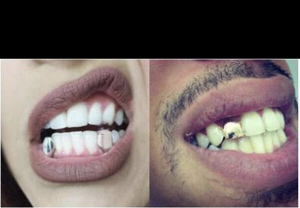 Gold Grillz Mouth teeth Top Tooth Single Grill Cap - Image 2