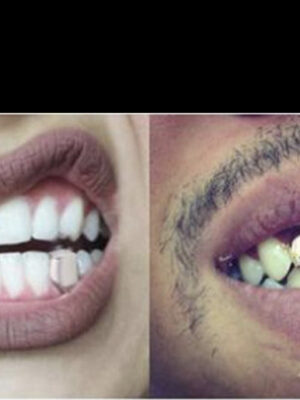 Gold Grillz Mouth teeth Top Tooth Single Grill Cap