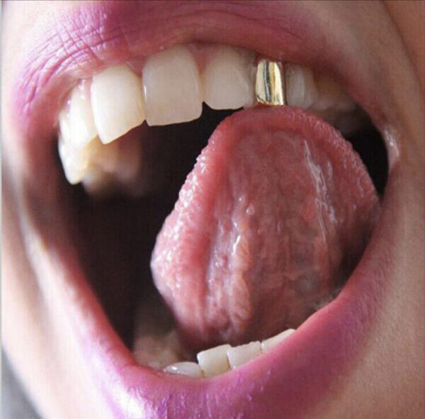 Gold Grillz Mouth teeth Top Tooth Single Grill Cap - Image 3