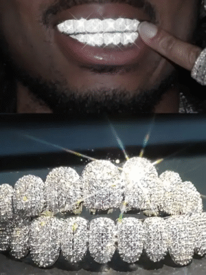 14k Baguette Joker Gold Teeth