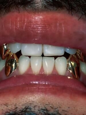 Unisex Gold Grillz Fangs Set  OF 4