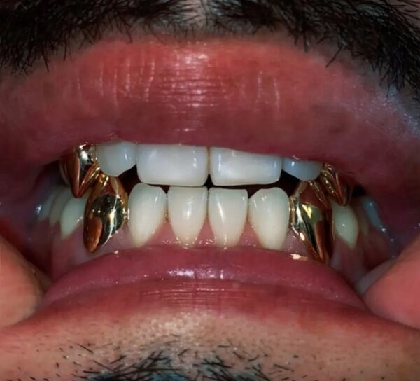 Unisex Gold Grillz Fangs Set  OF 4
